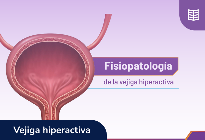 Fisiopatología de la Vejiga hiperactiva